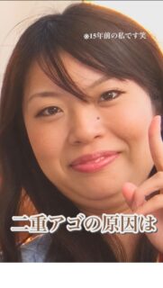 二重あごの原因、
【背中】って知ってますか？

・肩甲骨まわりガチガチ
・猫背で背中が丸まる
・長時間スマホを見ることが多い

その状態、放置すると…

・フェイスラインがぼやけて顔が大きくなる
・写真をとったら二重あごが目立つ
・横顔が老けて見える

こんな影響が出やすくなります。

だからこそ
40代からの二重あご改善は
背中から整えることが大切なんです。

何をしても二重あごが改善しない
最近フェイスラインがぼやけてきた…

「私のことかも」と思った方💡
ぜひ一度、ご相談ください。

——– 当サロンについて———⁣

当店はお顔の悩みを根本改善するために
【正しい習慣】を身につけていただくサロンです。
＊当店はその場しのぎのケアは行いません。
お顔のたるみは根本改善をしていかなければ、数日たてば元に戻るという堂々めぐりになってしまうからです。

＊お顔の悩みを改善するための正しい習慣を身につけていく為、施術1回のケアではなくプログラムは6週間かけて週1回の集中ケアを行っています。

——– MEGUMI式メソッドとは？———⁣

身体と肌の仕組みに基づき、たるみの根本原因となる身体の歪み、リンパのつまり、表情筋の凝り固まり、皮膚のターンオーバーの乱れ、すべてを整えて元の状態に戻していくプログラムになります。

━━━━━━━━━━━━━━

見た目年齢マイナス5歳✨
あなたの【たるみ悩み】お任せください！
📍ご体験はプロフィールからリンクへ

ﾟ+:｡.｡:+ﾟﾟ+:｡.｡:+ﾟﾟ+:｡.｡:+ﾟﾟ+:｡.｡:+ﾟﾟ+:

【東京・浅草橋】　
40代からのたるみ顔専門サロン✨
📌総武線浅草橋駅・西口改札から徒歩3分

＼整形しなくても若返る／
・ぼやけた輪郭をシャープに変えて横顔美人に
・首・肩を流してお顔を引き上げる
・この先のキレイも徹底管理
​
・