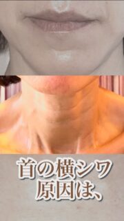 首の横シワ、原因って知ってますか？

・胸の筋肉がガチガチ
・肩こりが当たり前になっている
・巻き肩が戻らない

そのままにすると…

・首の横ジワが深くなりやすい
・首が短く見えて老けた印象に
・フェイスラインまでたるむ

こんな影響が出やすくなります。

だからこそ
40代からの、首の横シワ改善は
身体から緩めることが大切なんです。

「私のことかも」と思った方は、
ぜひ一度、ご相談ください。

——– 当サロンについて———⁣

当店はお顔の悩みを根本改善するために
【正しい習慣】を身につけていただくサロンです。
＊当店はその場しのぎのケアは行いません。
お顔のたるみは根本改善をしていかなければ、数日たてば元に戻るという堂々めぐりになってしまうからです。

＊お顔の悩みを改善するための正しい習慣を身につけていく為、施術1回のケアではなくプログラムは6週間かけて週1回の集中ケアを行っています。

——– MEGUMI式メソッドとは？———⁣

身体と肌の仕組みに基づき、たるみの根本原因となる身体の歪み、リンパのつまり、表情筋の凝り固まり、皮膚のターンオーバーの乱れ、すべてを整えて元の状態に戻していくプログラムになります。

━━━━━━━━━━━━━━

見た目年齢マイナス5歳✨
あなたの【たるみ悩み】お任せください！
📍ご体験はプロフィールからリンクへ

ﾟ+:｡.｡:+ﾟﾟ+:｡.｡:+ﾟﾟ+:｡.｡:+ﾟﾟ+:｡.｡:+ﾟﾟ+:

【東京・浅草橋】　
40代からのたるみ顔専門サロン✨
📌総武線浅草橋駅・西口改札から徒歩3分

＼整形しなくても若返る／
・ぼやけた輪郭をシャープに変えて横顔美人に
・首・肩を流してお顔を引き上げる
・この先のキレイも徹底管理
​
・エステ歴20年／施術実績1.9万人
・エステ技術国際ライセンス保持
​
体験はこちら👇
【2つの�